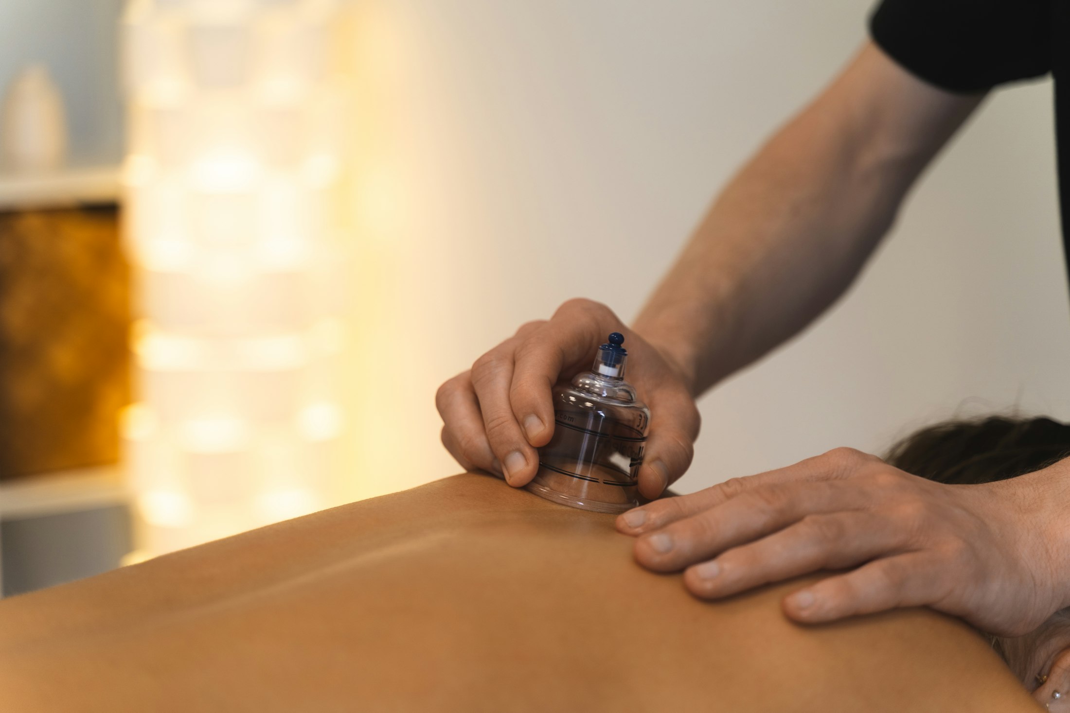 A therapist setting a small clear silicone cup down on a person's upper back.